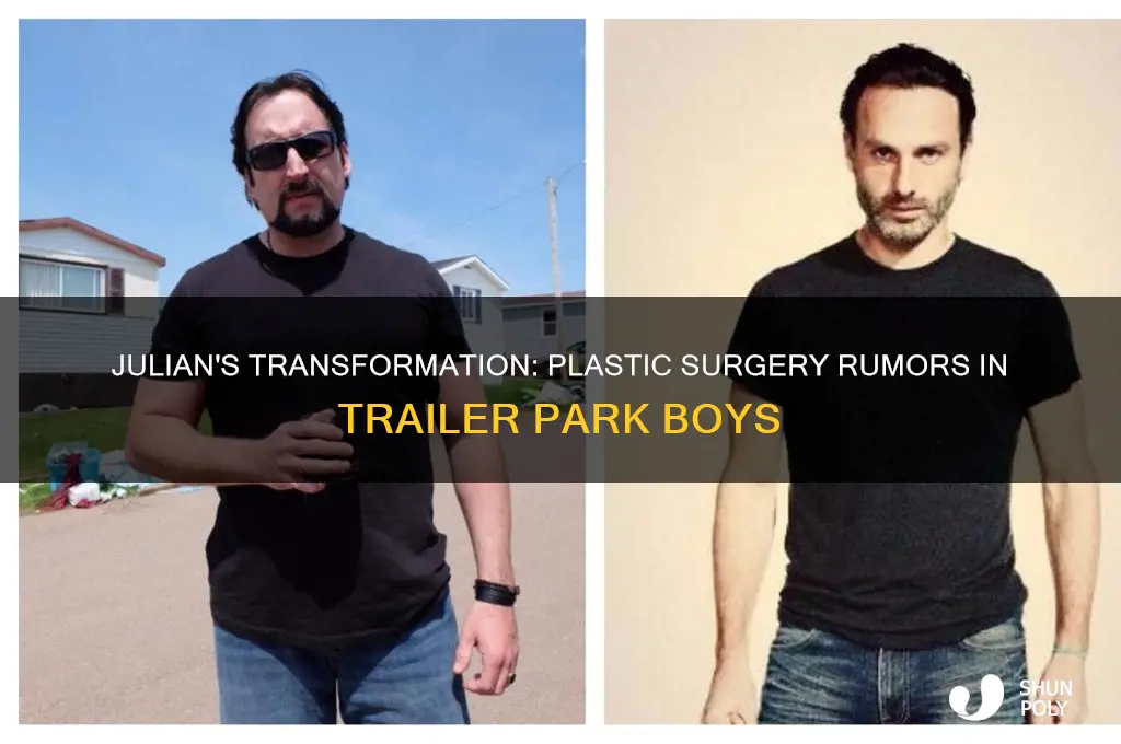 did julian have plastic surgery trailer park boys
