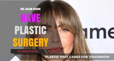 Julian Hough's Transformation: Plastic Surgery Rumors Explored and Debunked