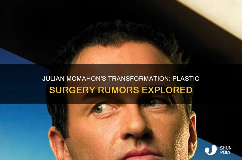 did julian mcmahon have plastic surgery