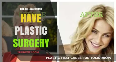Juliana Hough's Transformation: Plastic Surgery Rumors and Reality