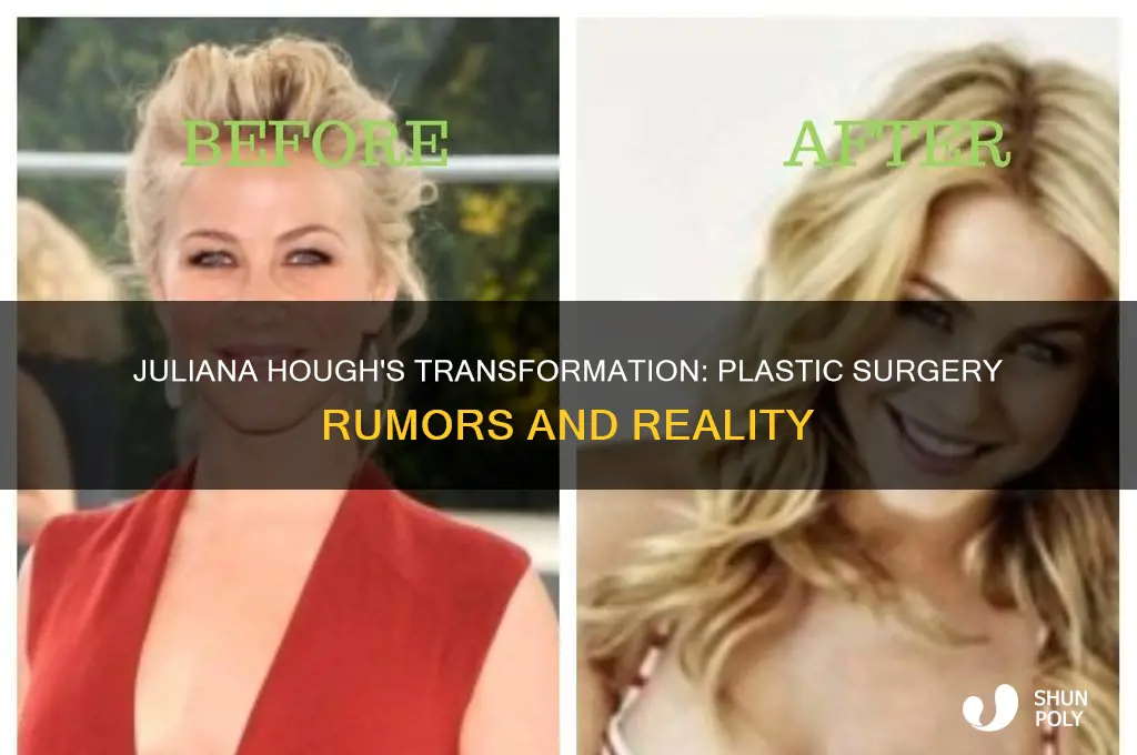 did juliana hough have plastic surgery