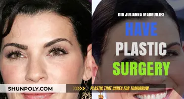 Julianna Margulies Plastic Surgery: Fact-Checking the Rumors and Speculations