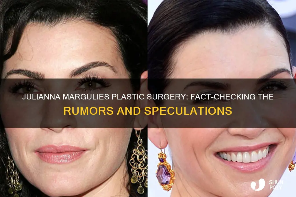 did julianna marguilies have plastic surgery