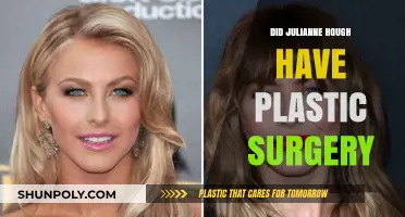 Julianne Hough's Transformation: Plastic Surgery Rumors Explored