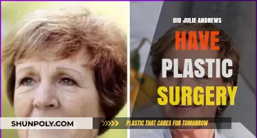 Julie Andrews Plastic Surgery: Fact-Checking the Rumors and Speculations