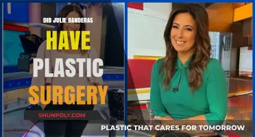Julie Banderas Plastic Surgery: Fact-Checking Rumors and Speculations