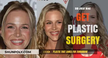 Julie Benz Plastic Surgery: Fact-Checking the Rumors and Speculations