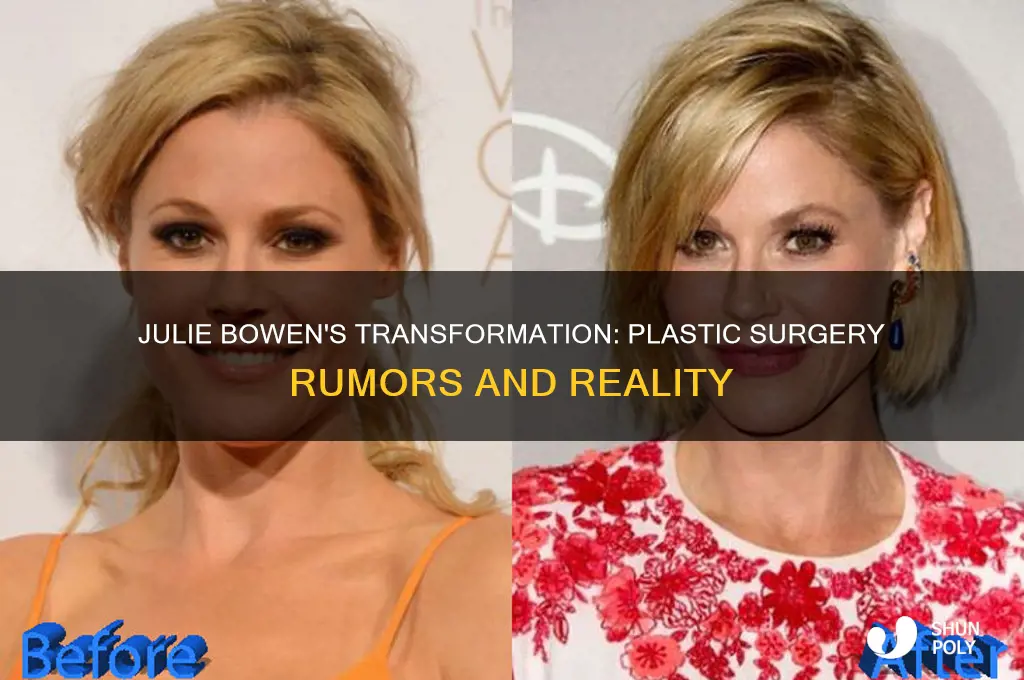 did julie bowen have plastic surgery