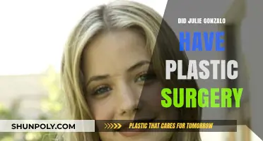 Julie Gonzalo Plastic Surgery: Fact-Checking the Rumors and Speculations