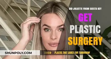 Did Juliette Porter from Siesta Key Undergo Plastic Surgery?