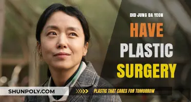 Jung Da Yeon's Transformation: Plastic Surgery Rumors Explored