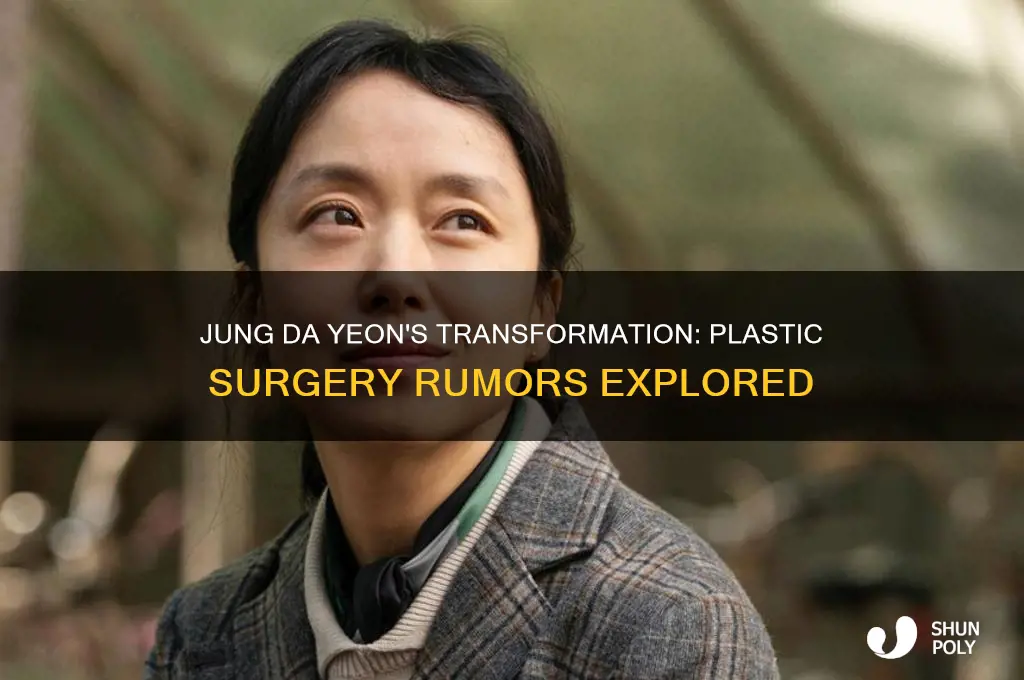did jung da yeon have plastic surgery