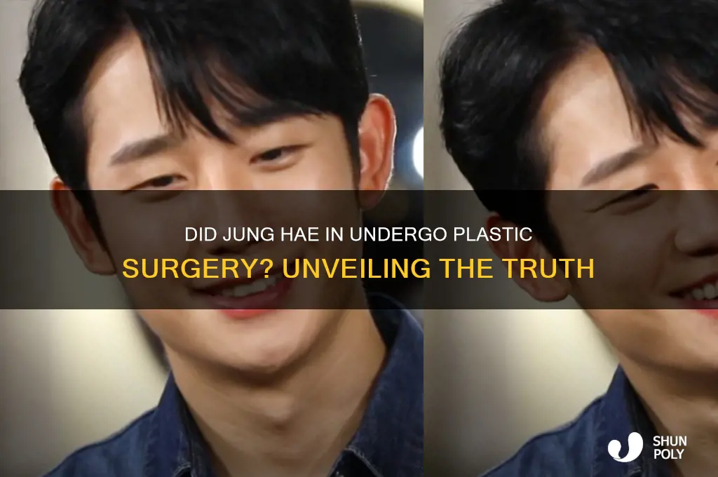 did jung hae in do plastic surgery