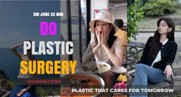 Jung So Min's Transformation: Plastic Surgery Rumors Explored