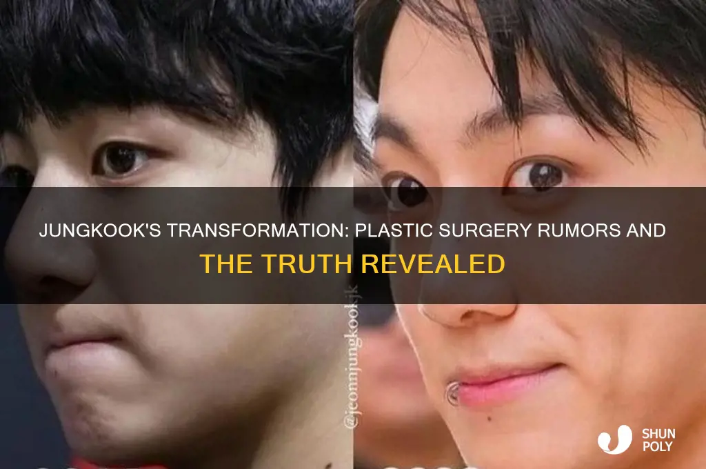 did jungkook get plastic surgery