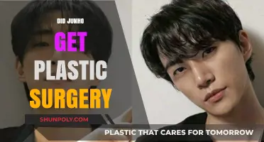 Junho's Transformation: Plastic Surgery Speculations and the Truth Behind Them