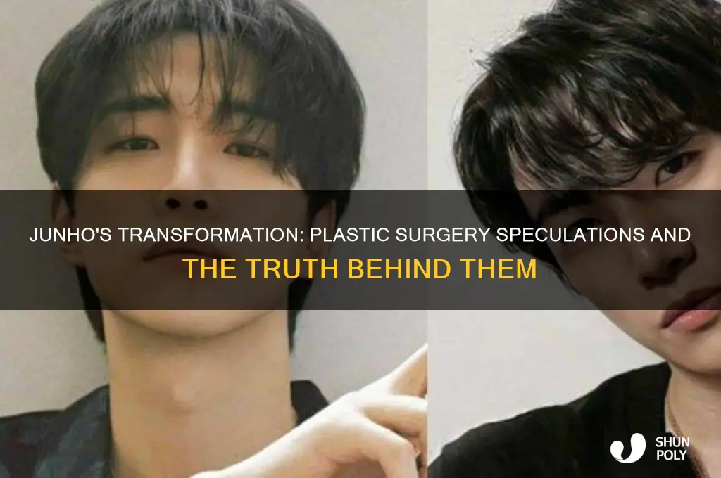 did junho get plastic surgery