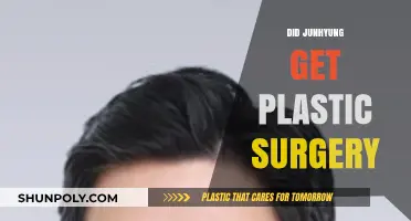 Junhyung's Transformation: Plastic Surgery Rumors and the Truth Behind Them