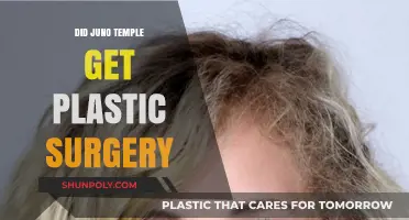 Juno Temple's Transformation: Plastic Surgery Speculations and Truths