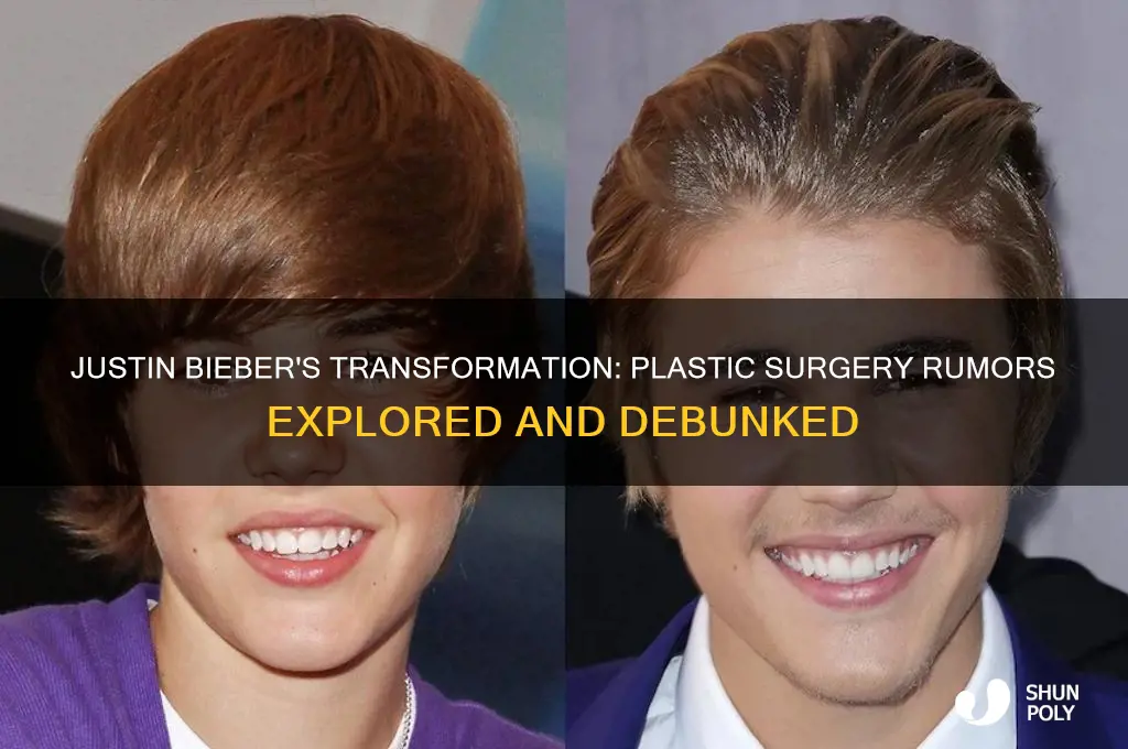 did justin bieber get plastic surgery