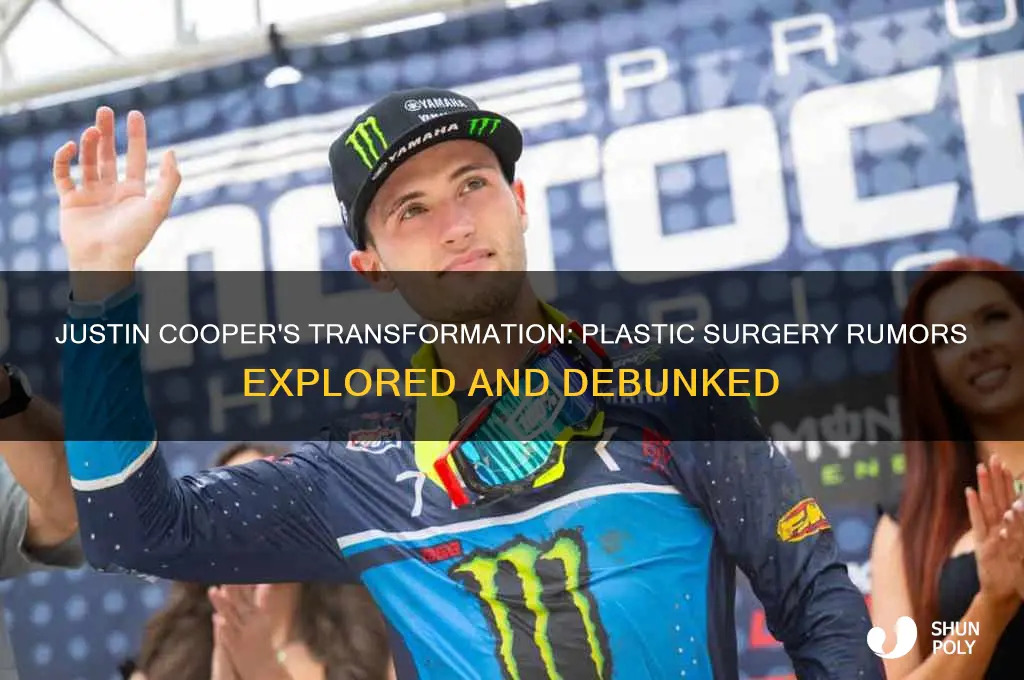 did justin cooper get plastic surgery done