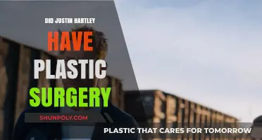 Justin Hartley's Transformation: Plastic Surgery Rumors Explored