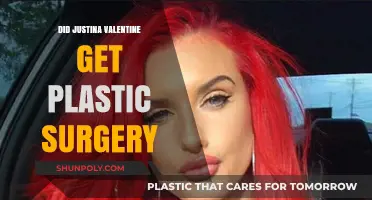 Justina Valentine's Transformation: Plastic Surgery Rumors Explored