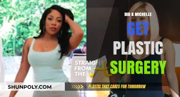 Did K. Michelle Undergo Plastic Surgery? Unveiling the Truth
