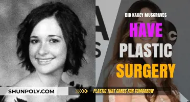 Kacey Musgraves Plastic Surgery Rumors: Fact or Fiction?