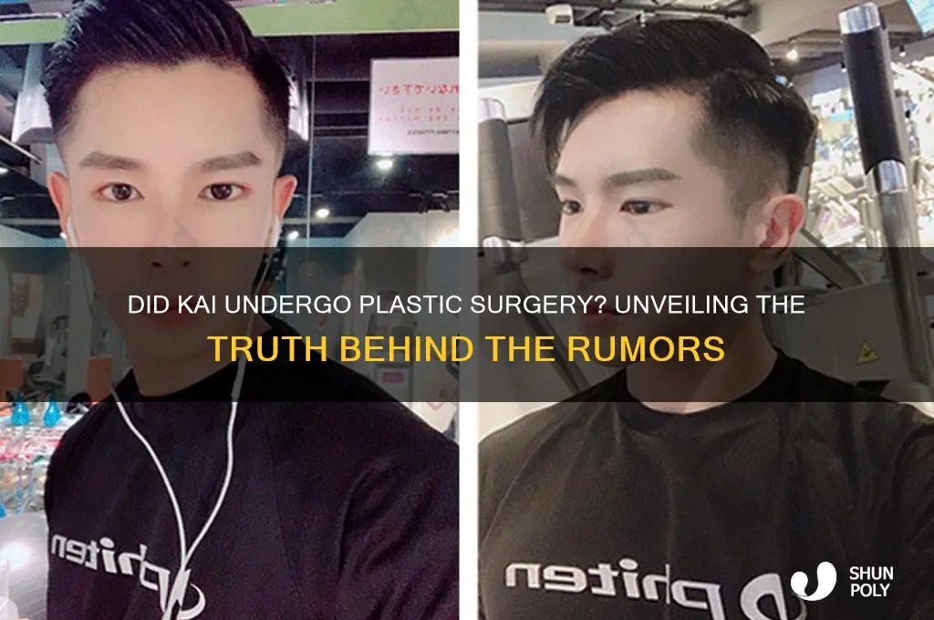 did kai get plastic surgery