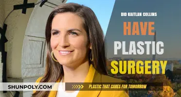 Kaitlan Collins Plastic Surgery: Fact-Checking the Rumors and Speculations
