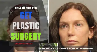Kaitlin Armstrong's Transformation: Plastic Surgery Rumors Explored