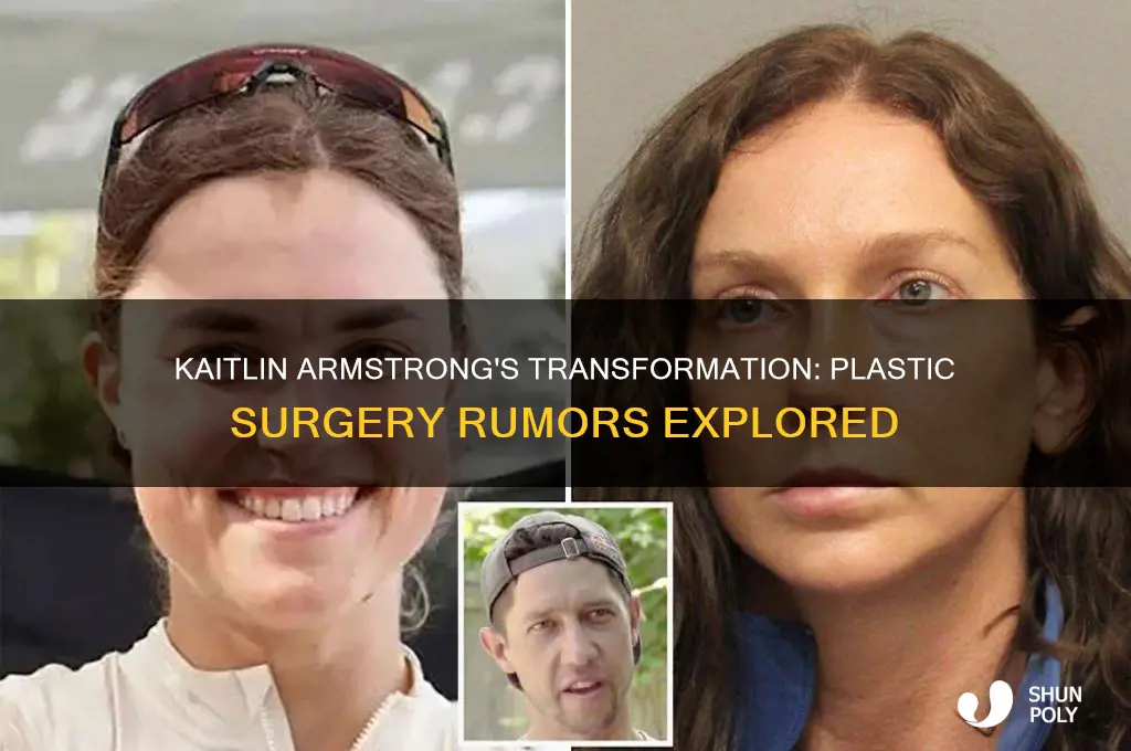did kaitlin armstrong get plastic surgery