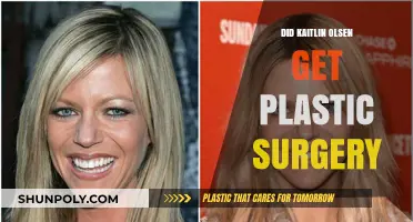 Kaitlin Olson's Transformation: Plastic Surgery Rumors Explored