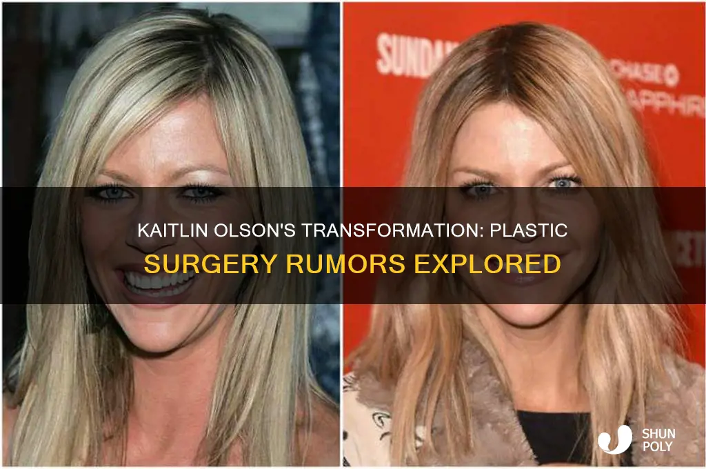 did kaitlin olsen get plastic surgery