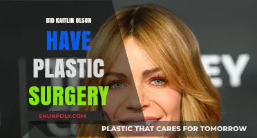 Kaitlin Olson's Transformation: Plastic Surgery Rumors Explored and Debunked