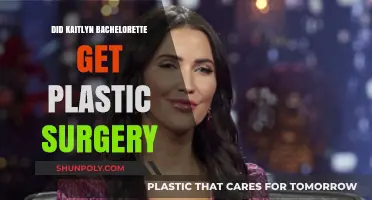 Kaitlyn Bristowe's Transformation: Plastic Surgery Speculations Explored