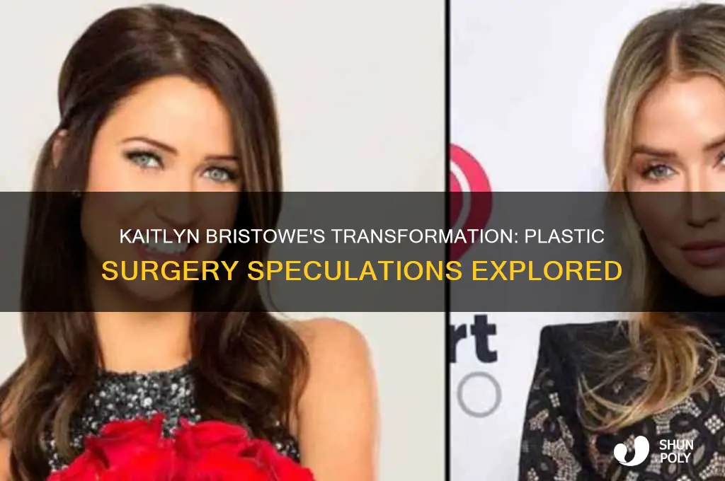 did kaitlyn bachelorette get plastic surgery