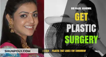 Kajal Agarwal's Transformation: Plastic Surgery Rumors Explored and Debunked