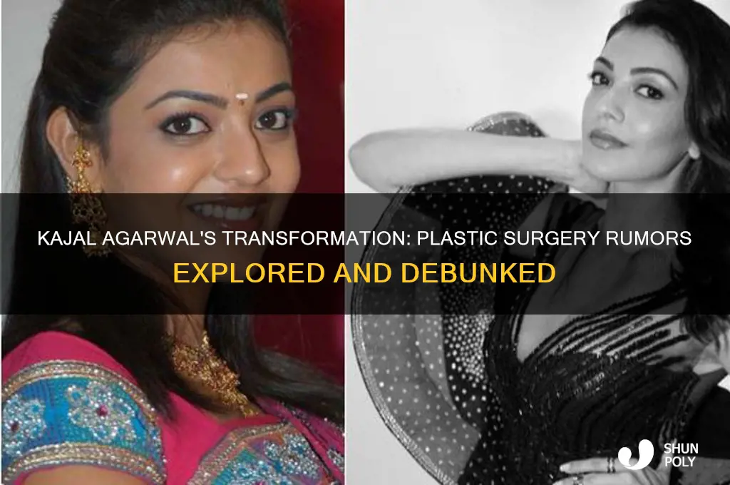 did kajal agarwal get plastic surgery