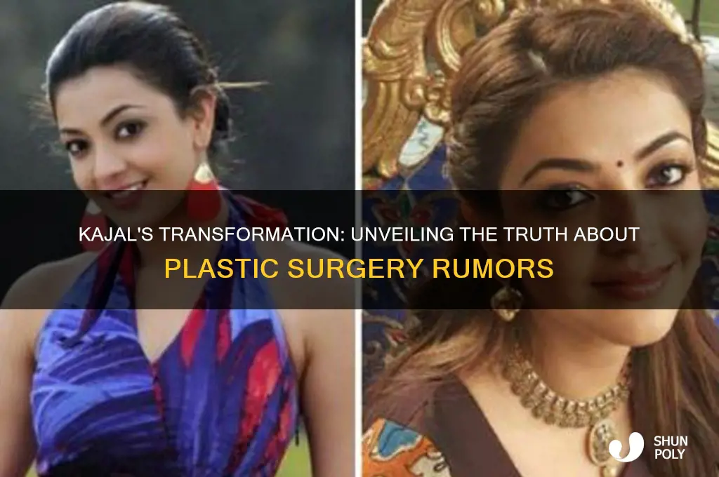 did kajal do plastic surgery