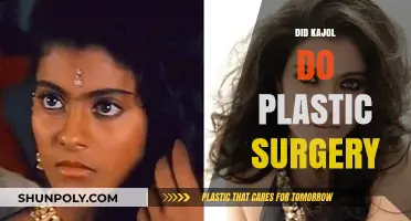 Kajol's Transformation: Plastic Surgery Rumors and the Truth Behind Them