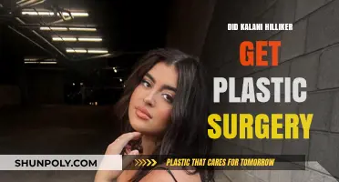 Kalani Hilliker Plastic Surgery: Fact-Checking the Rumors and Speculations