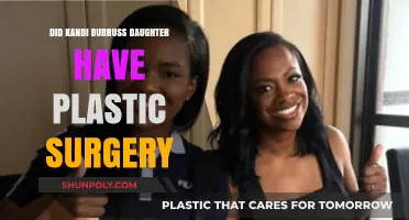 Kandi Burruss' Daughter Plastic Surgery Speculations: Fact or Fiction?