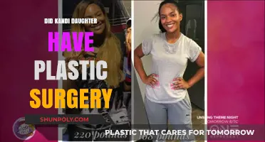 Kandi Burruss' Daughter's Transformation: Plastic Surgery Speculations Explored