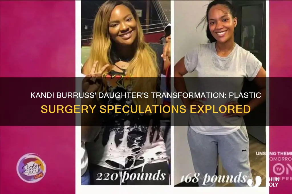 did kandi daughter have plastic surgery
