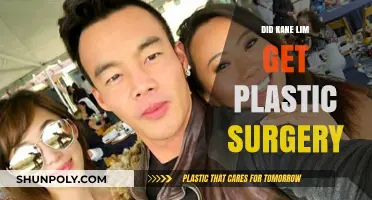 Kane Lim's Transformation: Plastic Surgery Rumors Explored and Debunked