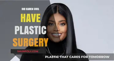 Karen Civil's Transformation: Plastic Surgery Speculations and Truths Revealed