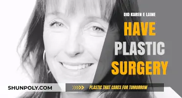 Karen E Laine Plastic Surgery: Fact-Checking the Rumors and Speculations