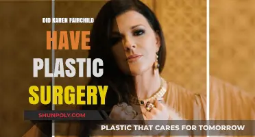 Karen Fairchild's Transformation: Plastic Surgery Speculations and Truths